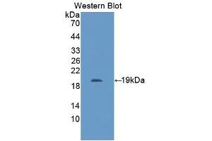 Detection of Recombinant IL11Ra, Mouse using Polyclonal Antibody to Interleukin 11 Receptor Alpha (IL11Ra) (IL11RA 抗体  (AA 59-217))