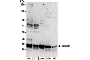 Western Blotting (WB) image for anti-Chromosome 1 Open Reading Frame 144 (C1orf144) (AA 102-152) antibody (ABIN7449837)