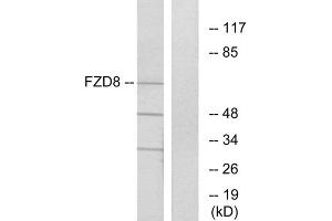 Western blot analysis of extracts from Jurkat cells, using FZD8 antibody. (FZD8 抗体  (C-Term))