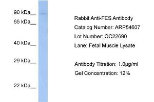 Western Blotting (WB) image for anti-Feline Sarcoma Oncogene (FES) (N-Term) antibody (ABIN2785795) (FES 抗体  (N-Term))