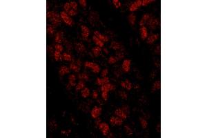 Immunofluorescence (IF) image for anti-CTF18, Chromosome Transmission Fidelity Factor 18 Homolog (CHTF18) (AA 25-75) antibody (ABIN7448948)