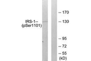 Western blot analysis of extracts from COS7 cells treated with Calyculin A 50ng/ml 30', using IRS-1 (Phospho-Ser1101) Antibody. (IRS1 抗体  (pSer1101))
