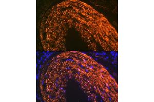 Immunofluorescence analysis of mouse large intestine using Calponin Rabbit mAb (ABIN1678670, ABIN3018018, ABIN3018019 and ABIN7101568) at dilution of 1:100 (40x lens). (CNN1 抗体)