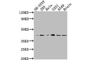 Western Blot Positive WB detected in: SH-SY5Y whole cell lysate, 293 whole cell lysate, Hela whole cell lysate, U251 whole cell lysate, A549 whole cell lysate, Mouse brain tissue All lanes: OPRD1 antibody at 1:2000 Secondary Goat polyclonal to rabbit IgG at 1/50000 dilution Predicted band size: 41 kDa Observed band size: 41 kDa (Recombinant OPRD1 抗体)