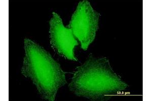 Immunofluorescence of purified MaxPab antibody to NXT1 on HeLa cell. (NXT1 抗体  (AA 1-140))