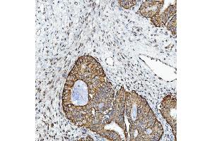 IHC analysis of GPCR RDC1/CXCR-7/ACKR3 using anti-GPCR RDC1/CXCR-7/ACKR3 antibody (ABIN7602889). (CXCR7 抗体  (C-Term))
