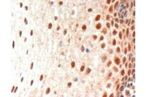 ABIN185216 (3µg/ml) staining of paraffin embedded Human Oesophagus. (Paired Box 3 抗体  (N-Term))