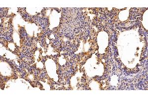 Immunohistochemistry (IHC) image for anti-Haptoglobin (HP) (AA 123-307) antibody (ABIN7432676)