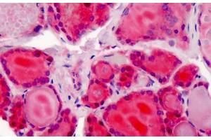 Human Thyroid: Formalin-Fixed, Paraffin-Embedded (FFPE) (XPO1 抗体  (AA 390-408))