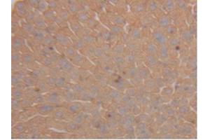 IHC-P analysis of Mouse Liver Tissue, with DAB staining. (Cytokeratin 18 抗体  (AA 1-423))