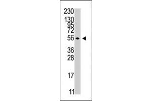 The STK38 polyclonal antibody  is used in Western blot to detect STK38 in Jurkat cell line lysates . (STK38 抗体  (C-Term))