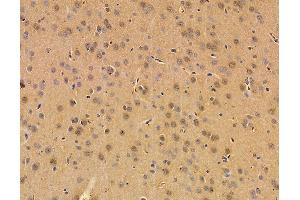 ABIN7095908 and ABIN7099970 at 1/100 staining rat brain tissue by IHC-P.