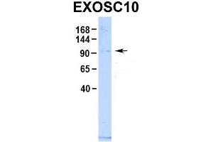 Host:  Rabbit  Target Name:  EXOSC10  Sample Type:  Human 293T  Antibody Dilution:  1. (EXOSC10 抗体  (C-Term))