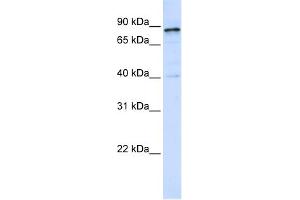 WB Suggested Anti-DNM1 Antibody Titration: 0. (Dynamin 1 抗体  (Middle Region))