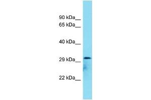 Host: Rabbit Target Name: C8orf74 Sample Type: COLO205 Whole Cell lysates Antibody Dilution: 1. (C8ORF74 抗体  (C-Term))