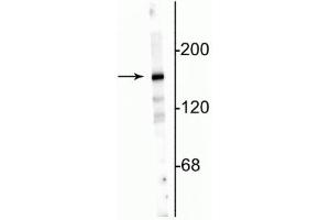 Western blot of 10 µg of rat hippocampal lysate showing specific immunolabeling of the ~180 kDa NR2A subunit. (NMDAR2A 抗体  (N-Term))