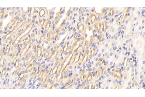 Immunohistochemistry (IHC) image for anti-Peptidylprolyl Isomerase A (Cyclophilin A) (PPIA) (AA 2-164) antibody (ABIN7432964)