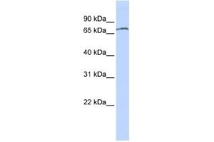 WB Suggested Anti-ZNF768 Antibody Titration: 0. (ZNF768 抗体  (N-Term))
