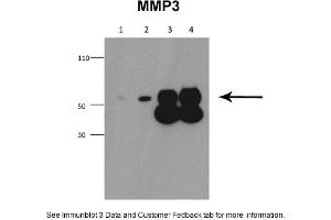 Sample Type: 1. (MMP3 抗体  (Middle Region))