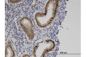 Immunostaining (ISt) image for anti-Zinc Finger, MYND-Type Containing 8 (ZMYND8) (AA 601-698) antibody (ABIN565131)