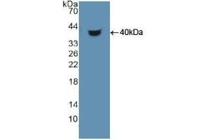 Detection of Recombinant HDGF, Human using Polyclonal Antibody to Hepatoma Derived Growth Factor (HDGF) (HDGF 抗体  (AA 10-240))