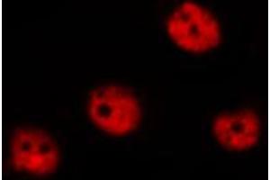 ABIN6267315 staining MOLT by IF/ICC. (Retinoblastoma 1 抗体  (pSer780))