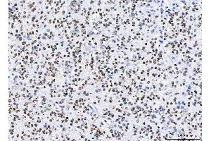 IHC analysis of HnRNP H/HNRNPH1 using anti-HnRNP H/HNRNPH1 antibody (ABIN4886623). (HNRNPH1 抗体  (N-Term))