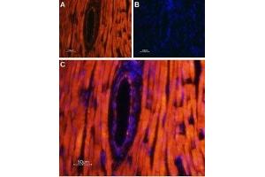 Expression of TRPML2 in rat heart - Immunohistochemical staining of rat heart paraffin-embedded sections using Anti-TRPML2 (Mucolipin-2) Antibody (ABIN7043337, ABIN7044041 and ABIN7044042), followed by AlexaFluor-555 secondary antibody. (Mucolipin 2 (MCOLN2) (AA 212-228), (Intracellular), (N-Term) 抗体)