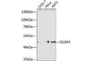 Western blot analysis of extracts of various cell lines, using DUSP4 antibody (ABIN3016539, ABIN3016540, ABIN3016541 and ABIN6219776) at 1:3000 dilution. (DUSP4 抗体  (AA 1-168))