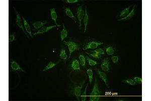 Immunofluorescence of monoclonal antibody to HTRA2 on HeLa cell. (HTRA2 抗体  (AA 359-458))