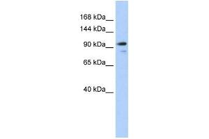 Human 293T; WB Suggested Anti-AMOTL1 Antibody Titration: 0. (AMOTL1 抗体  (N-Term))