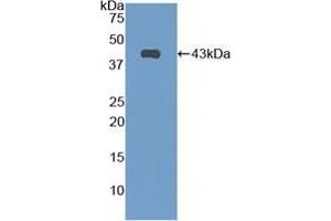 Western blot analysis of recombinant Mouse CNP.