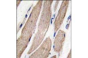 Image no. 1 for anti-Mitogen-Activated Protein Kinase Kinase 5 (MAP2K5) (Ser149) antibody (ABIN360284) (MAP2K5 抗体  (Ser149))