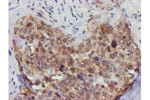 Image no. 1 for anti-F-Box Protein 21 (FBXO21) antibody (ABIN1498235) (FBXO21 抗体)
