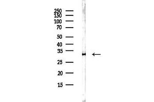 anti-Translocase of Inner Mitochondrial Membrane Domain Containing 1 (TIMMDC1) antibody