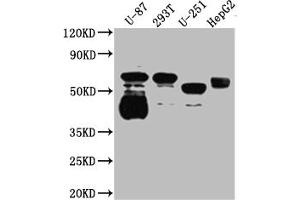 Western Blot Positive WB detected in: U-87 whole cell lysate, 293T whole cell lysate, U-251 whole cell lysate, HepG2 whole cell lysate All lanes: Serotonin transporter antibody at 1:1000 Secondary Goat polyclonal to rabbit IgG at 1/50000 dilution Predicted band size: 71, 75 kDa Observed band size: 55 kDa (Recombinant SLC6A4 抗体)
