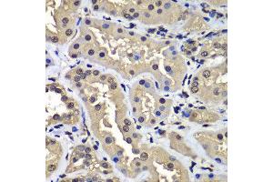 Immunohistochemistry of paraffin-embedded human kidney using CCAR2 antibody at dilution of 1:100 (x400 lens). (CCAR2 抗体)
