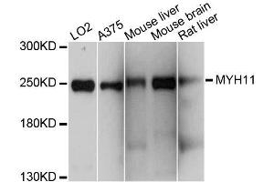 Western blot analysis of extracts of various cell lines, using MYH11 antibody. (MYH11 抗体  (AA 1680-1979))