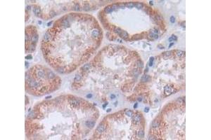 Used in DAB staining on fromalin fixed paraffin- embedded Kidney tissue (CCL14 抗体  (AA 20-93))