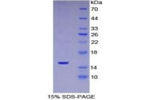 SDS-PAGE of Protein Standard from the Kit  (Highly purified E. (SERPING1 ELISA 试剂盒)