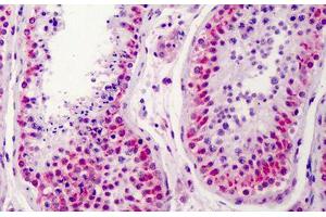 Human Testis: Formalin-Fixed, Paraffin-Embedded (FFPE) (NEK2 抗体  (AA 287-299))