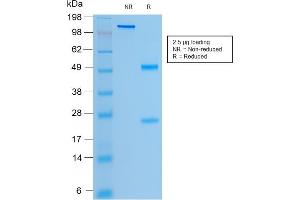 SDS-PAGE Analysis Purified CFTR Mouse Recombinant Monoclonal Antibody (rCFTR/1342). (Recombinant CFTR 抗体)