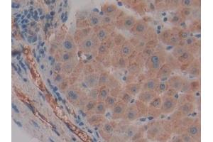 Detection of FGg in Human Liver Tissue using Polyclonal Antibody to Fibrinogen Gamma (FGg) (FGG 抗体  (AA 166-416))