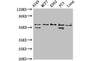 Western Blot Positive WB detected in: A549 whole cell lysate, MCF-7 whole cell lysate, K562 whole cell lysate, PC-3 whole cell lysate, Rat lung tissue All lanes: SERPING1 antibody at 2 μg/mL Secondary Goat polyclonal to rabbit IgG at 1/50000 dilution Predicted band size: 56, 50 kDa Observed band size: 56 kDa