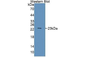 Western blot analysis of the recombinant protein. (ABCA9 抗体  (AA 1416-1583))