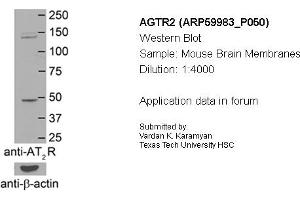 Western Blotting (WB) image for anti-Angiotensin II Receptor, Type 2 (AGTR2) (N-Term) antibody (ABIN2788290) (Angiotensin II Type 2 Receptor 抗体  (N-Term))