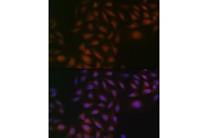 Immunofluorescence analysis of U-2 OS cells using Casein Kinase 2 beta (CSNK2B) (CSNK2B) Rabbit mAb (ABIN1680593, ABIN3019007, ABIN3019008 and ABIN7101698) at dilution of 1:100 (40x lens). (CSNK2B 抗体)
