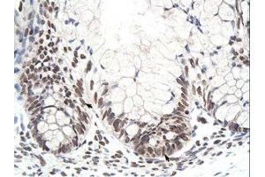 Image no. 1 for anti-Zinc Finger Protein 394 (ZNF394) (N-Term) antibody (ABIN6736210) (ZNF394 抗体  (N-Term))