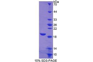 SDS-PAGE analysis of Human SIGLEC7 Protein. (SIGLEC7 蛋白)