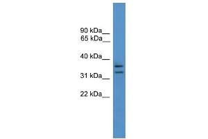 WB Suggested Anti-SCAMP3 Antibody Titration: 0. (SCAMP3 抗体  (N-Term))